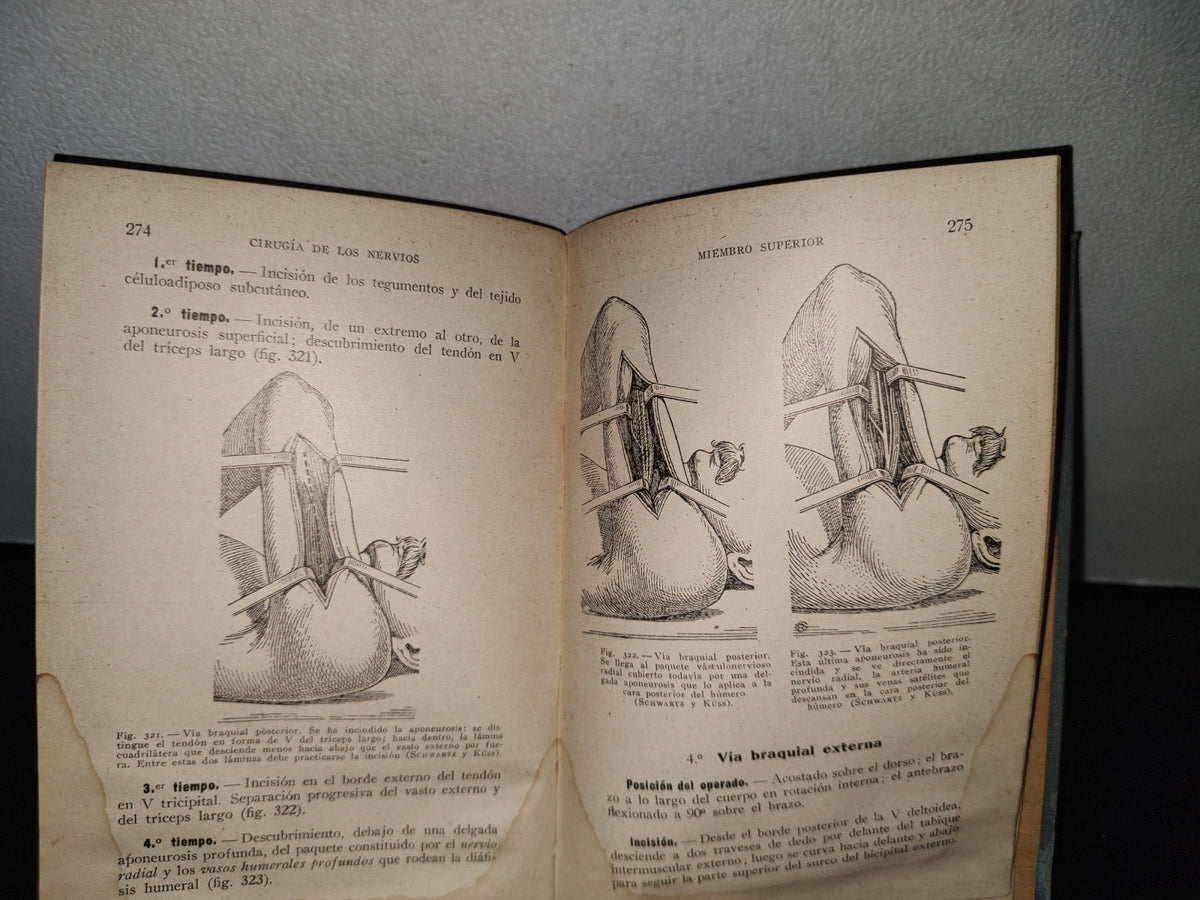 64- Cirugía Del Tórax Y Del Miembro Superior - A. Schwartz Y G. Métivet - 1933