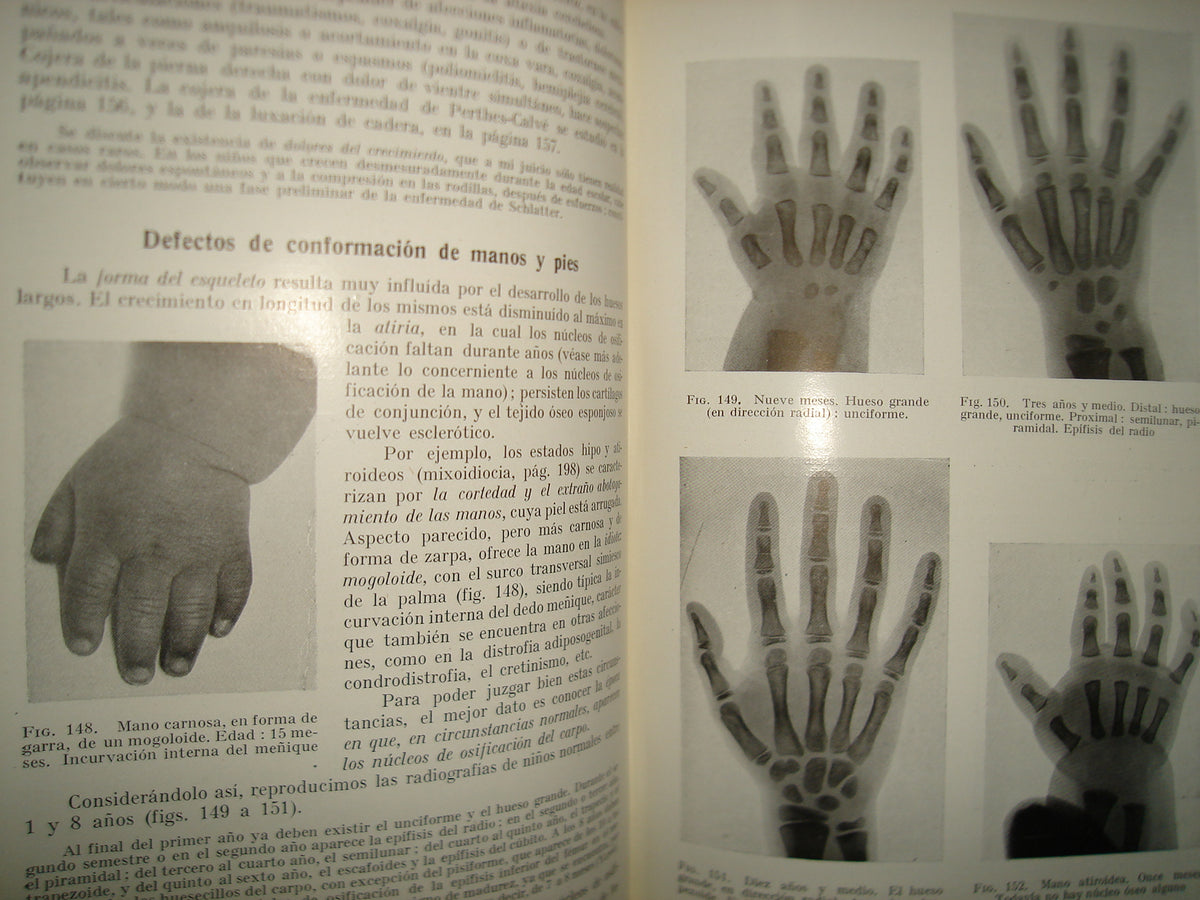 161- Diagnóstico De Las Enfermedades De Los Niños - Dr. E. Feer - Editorial Labor 1952