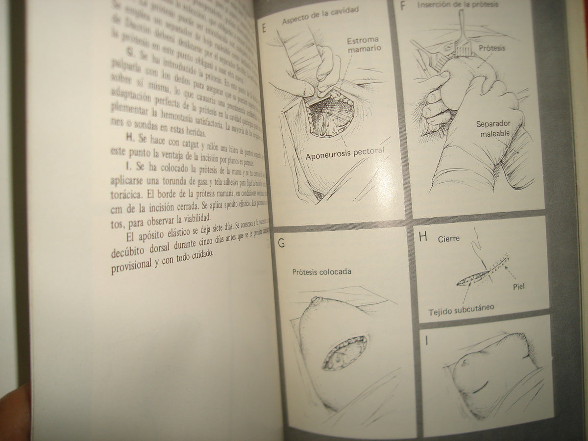 168- Cirugía De La Mama - Southwick, Slaughter, Humphrey - 1968