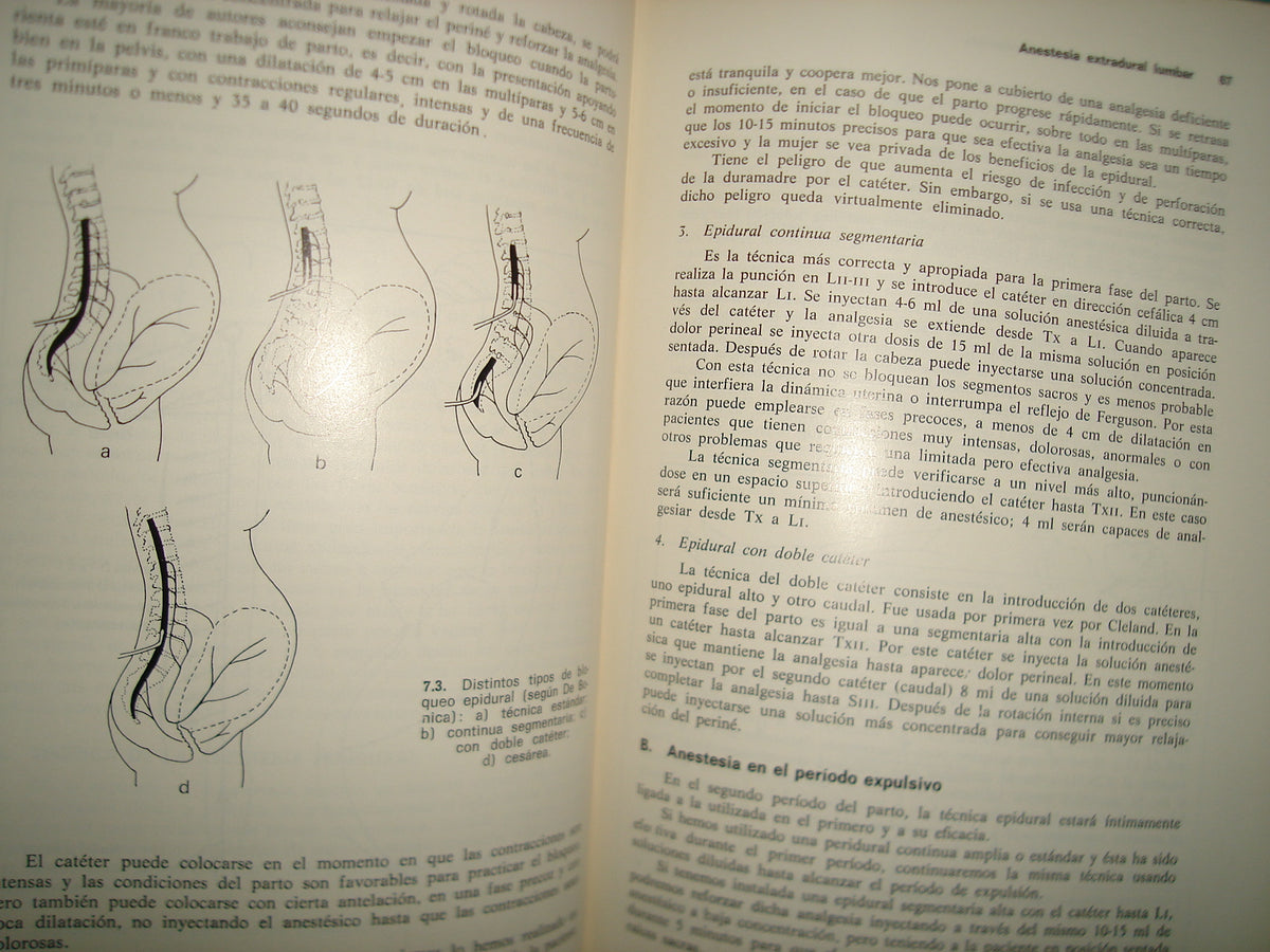 23- Clínica Ginecológica. Volumen 2, Número 2. Analgesia Y Anestesia En Obstetricia