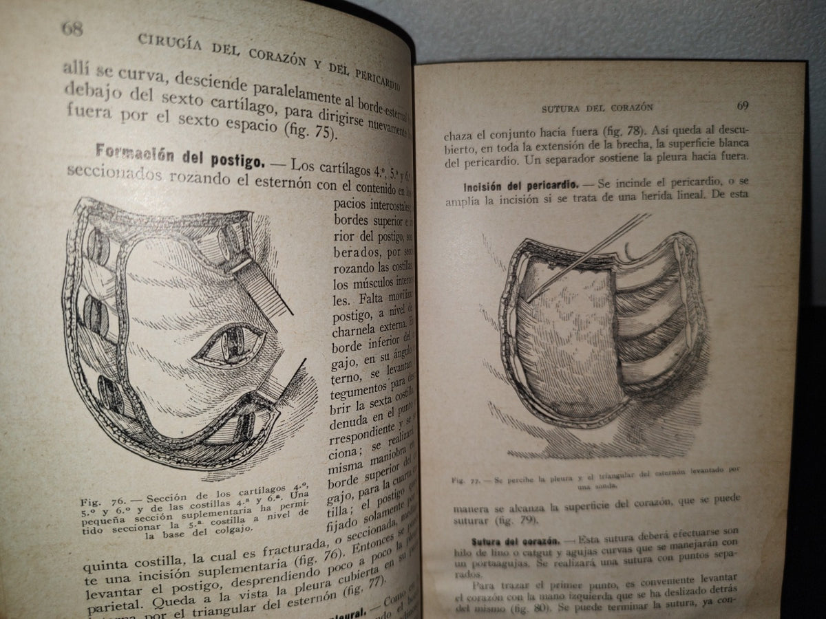 64- Cirugía Del Tórax Y Del Miembro Superior - A. Schwartz Y G. Métivet - 1933