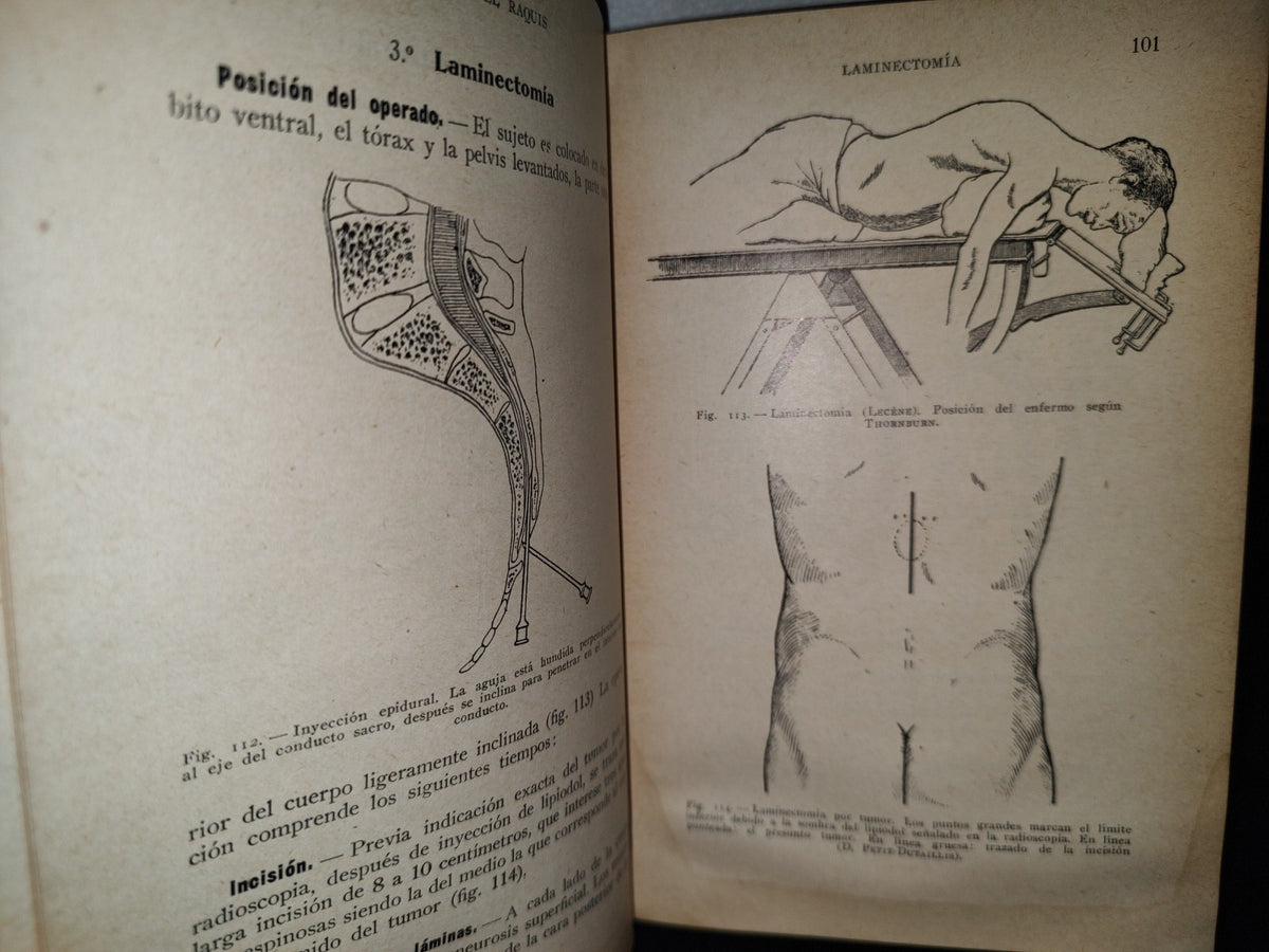 64- Cirugía Del Tórax Y Del Miembro Superior - A. Schwartz Y G. Métivet - 1933