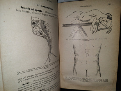 64- Cirugía Del Tórax Y Del Miembro Superior - A. Schwartz Y G. Métivet - 1933