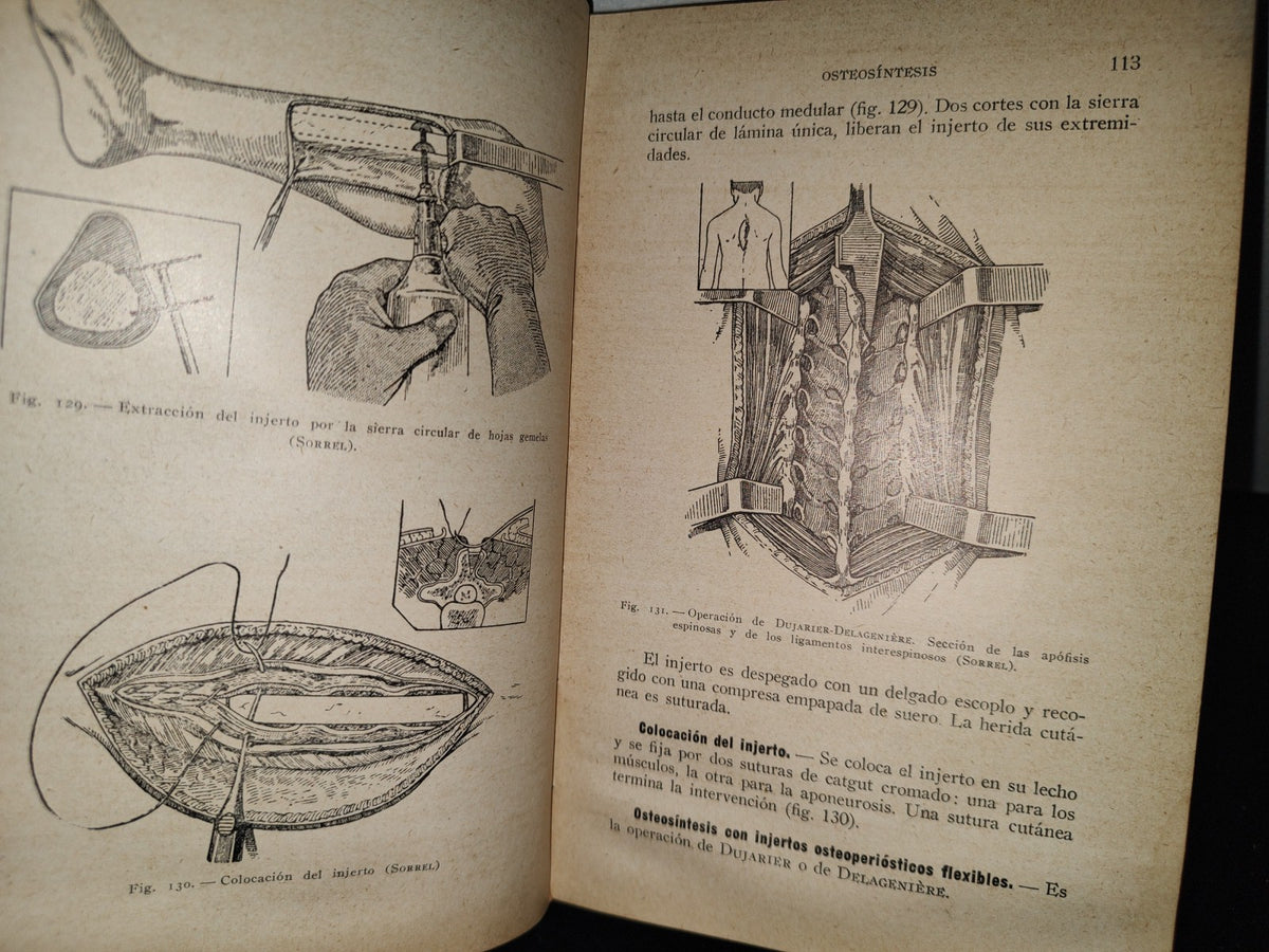 64- Cirugía Del Tórax Y Del Miembro Superior - A. Schwartz Y G. Métivet - 1933