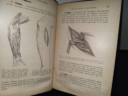 64- Cirugía Del Tórax Y Del Miembro Superior - A. Schwartz Y G. Métivet - 1933