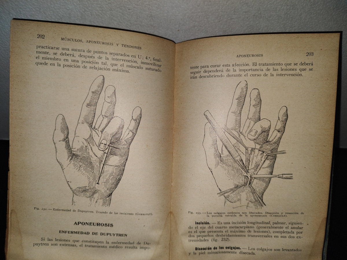 64- Cirugía Del Tórax Y Del Miembro Superior - A. Schwartz Y G. Métivet - 1933