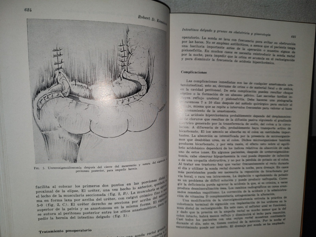 89- Clínicas Obstétricas Y Ginecológicas. El Parto Intestinal, Histrectomía Abdomnal