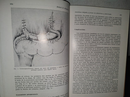 89- Clínicas Obstétricas Y Ginecológicas. El Parto Intestinal, Histrectomía Abdomnal