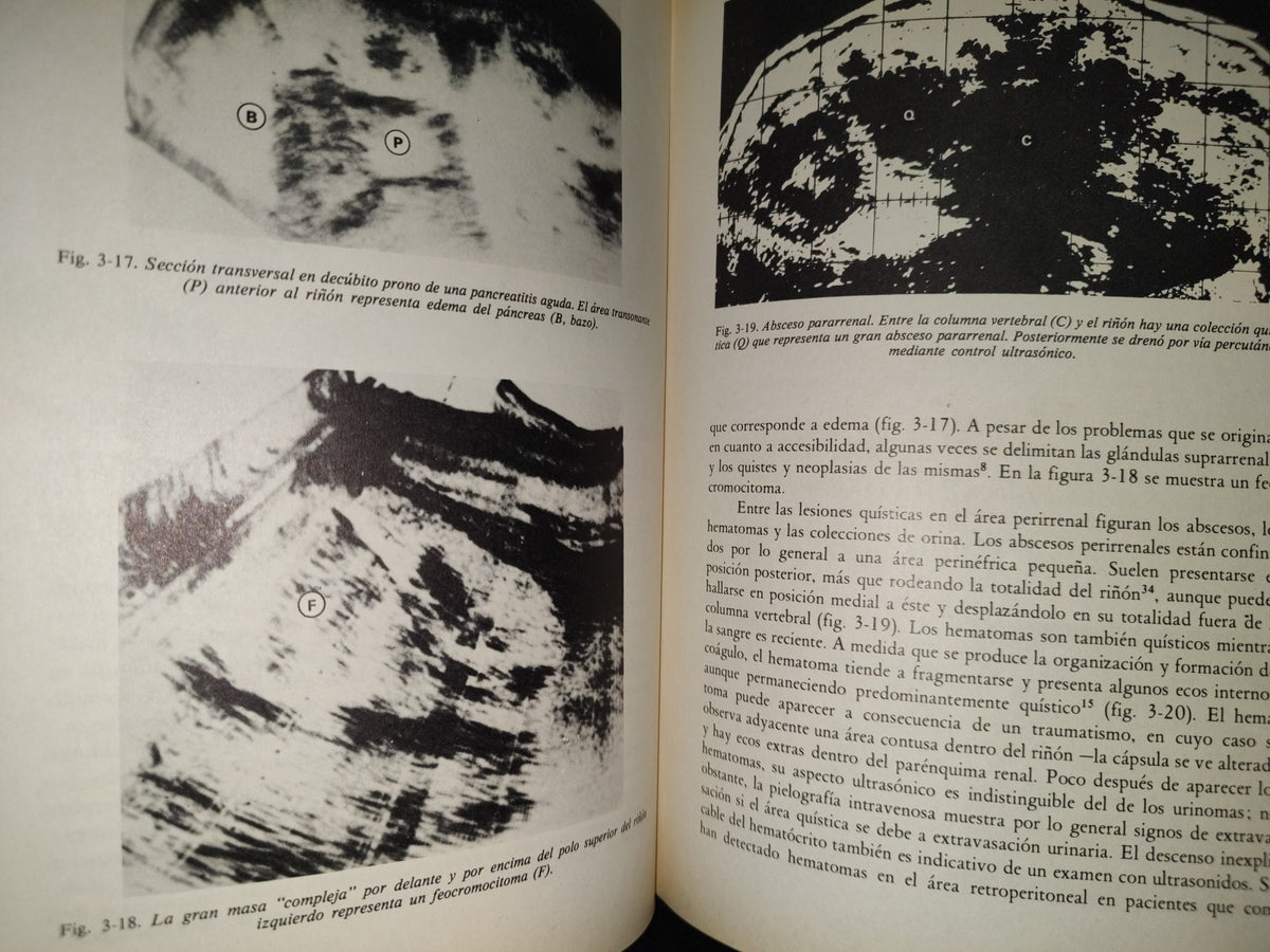 202- Clínica Radiológica. Ultrasonidos 1/3 - Roger C. Sanders