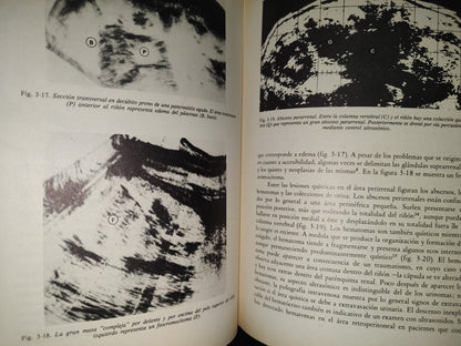 202- Clínica Radiológica. Ultrasonidos 1/3 - Roger C. Sanders