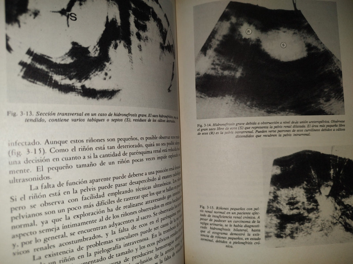 202- Clínica Radiológica. Ultrasonidos 1/3 - Roger C. Sanders