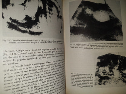 202- Clínica Radiológica. Ultrasonidos 1/3 - Roger C. Sanders