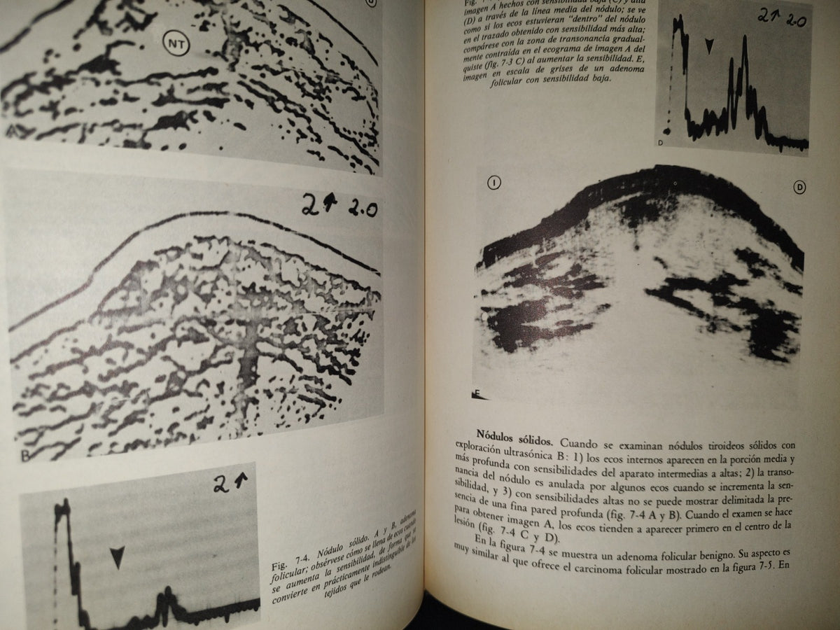 202- Clínica Radiológica. Ultrasonidos 1/3 - Roger C. Sanders