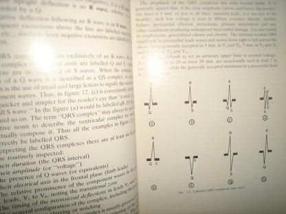 160- Electrocardiografía Práctica / Practical Electrocardiography Henry J. L. Marriott - 1981