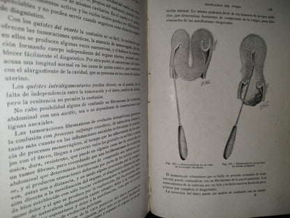 91- Antiguo Tratado De Ginecología - Dr. S. Recasens - Madrid: 1918