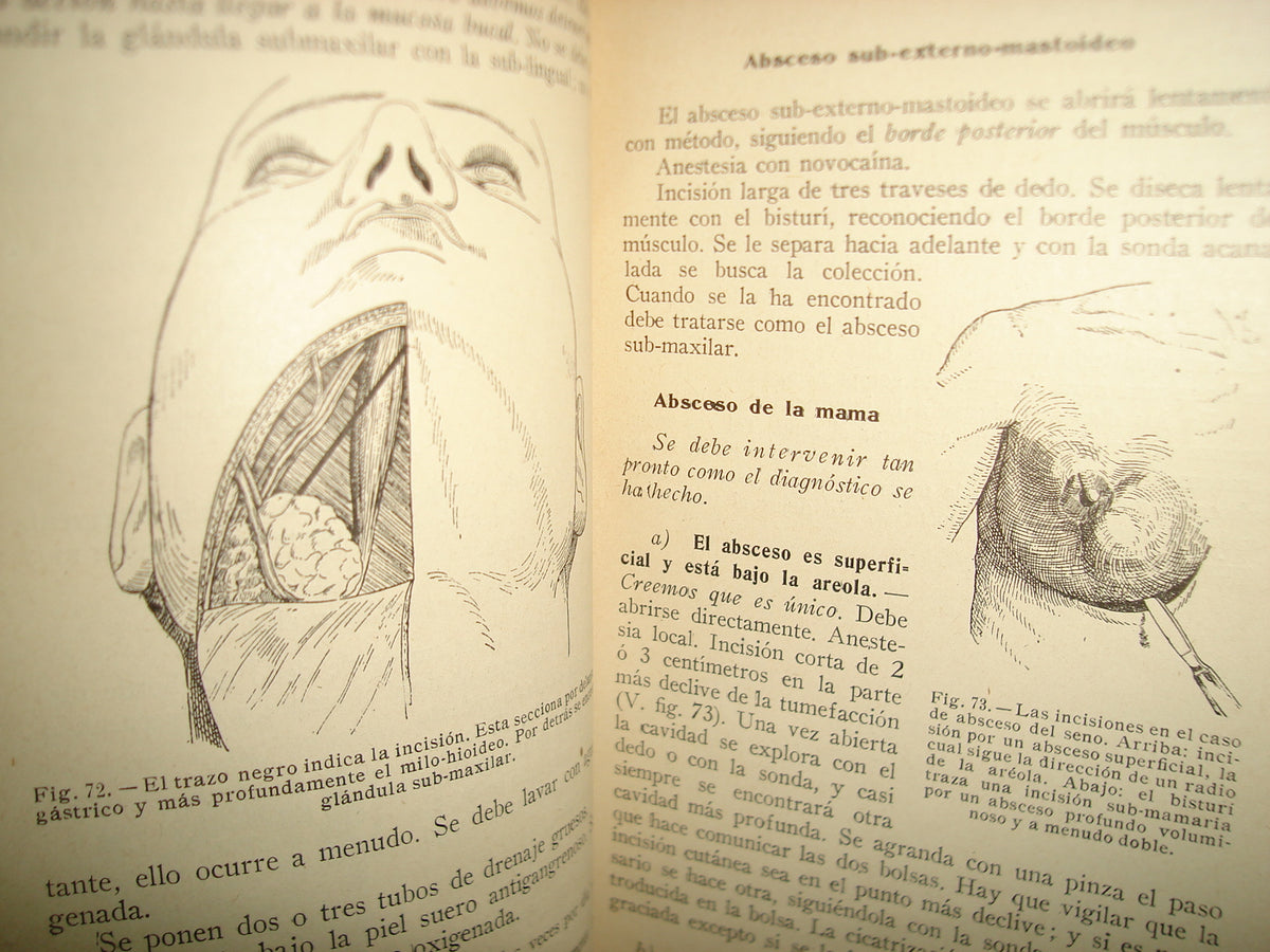 160- Práctica Corriente Y Cirugía De Urgencia - V. Veau Y F. D'Allaines - 1928