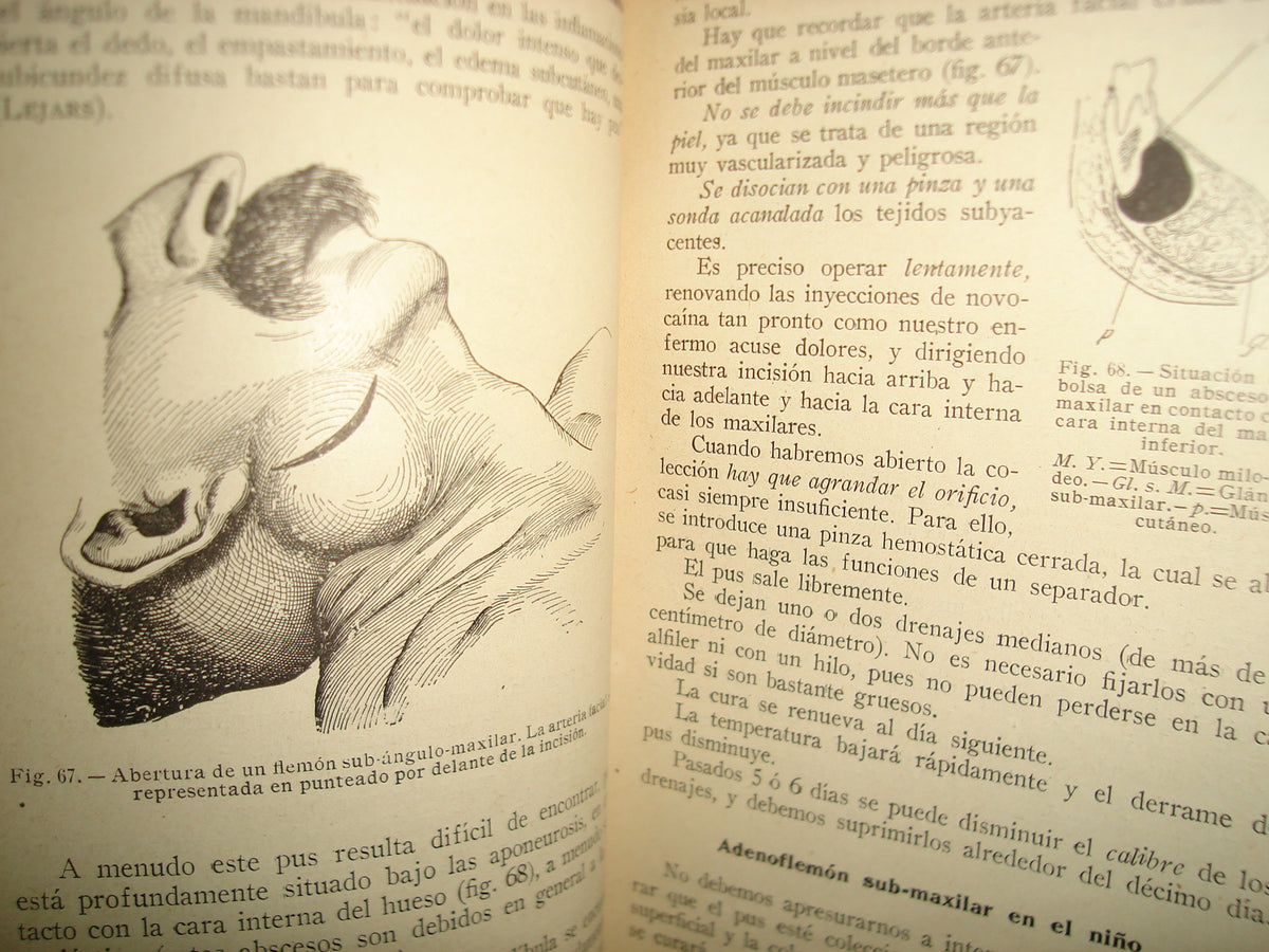160- Práctica Corriente Y Cirugía De Urgencia - V. Veau Y F. D'Allaines - 1928