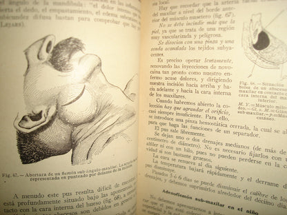 160- Práctica Corriente Y Cirugía De Urgencia - V. Veau Y F. D'Allaines - 1928