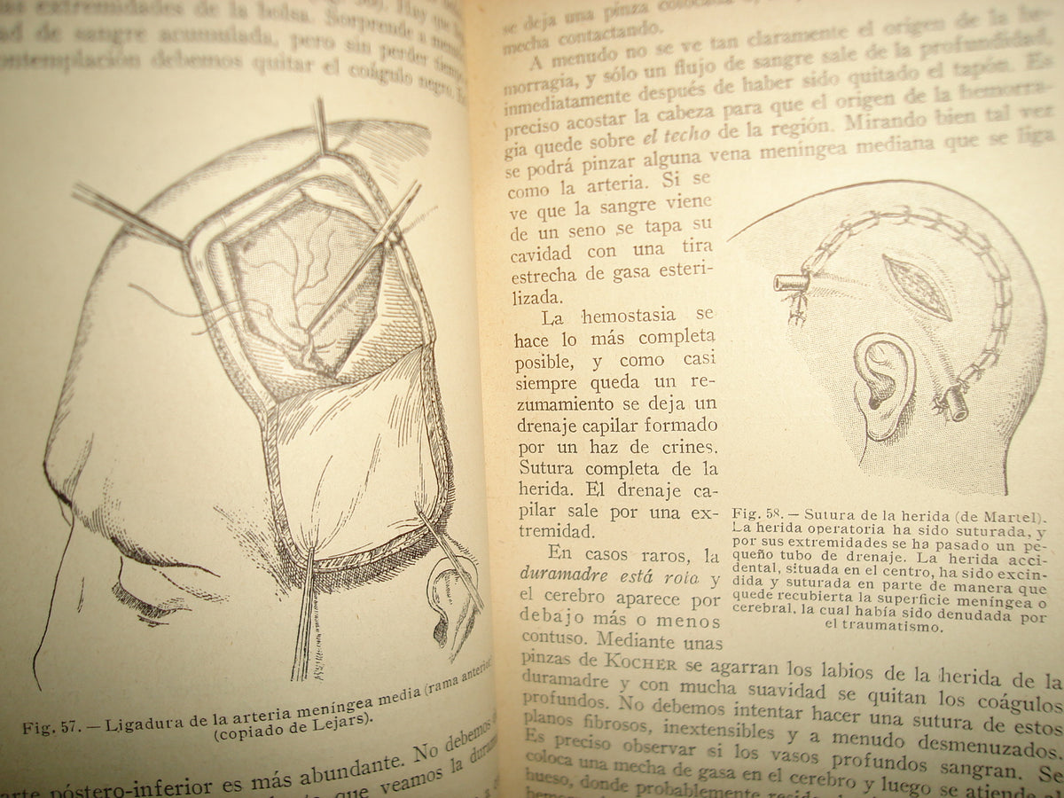 160- Práctica Corriente Y Cirugía De Urgencia - V. Veau Y F. D'Allaines - 1928