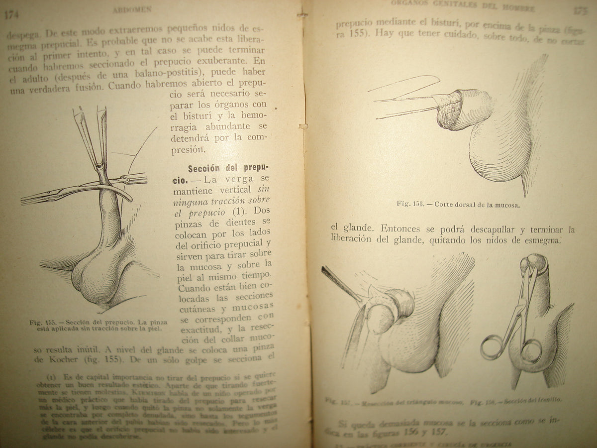 160- Práctica Corriente Y Cirugía De Urgencia - V. Veau Y F. D'Allaines - 1928