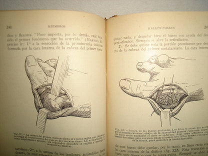 160- Práctica Corriente Y Cirugía De Urgencia - V. Veau Y F. D'Allaines - 1928