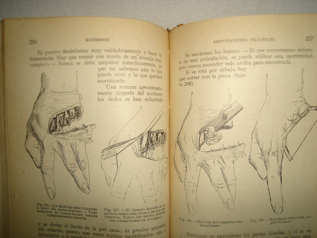 160- Práctica Corriente Y Cirugía De Urgencia - V. Veau Y F. D'Allaines - 1928