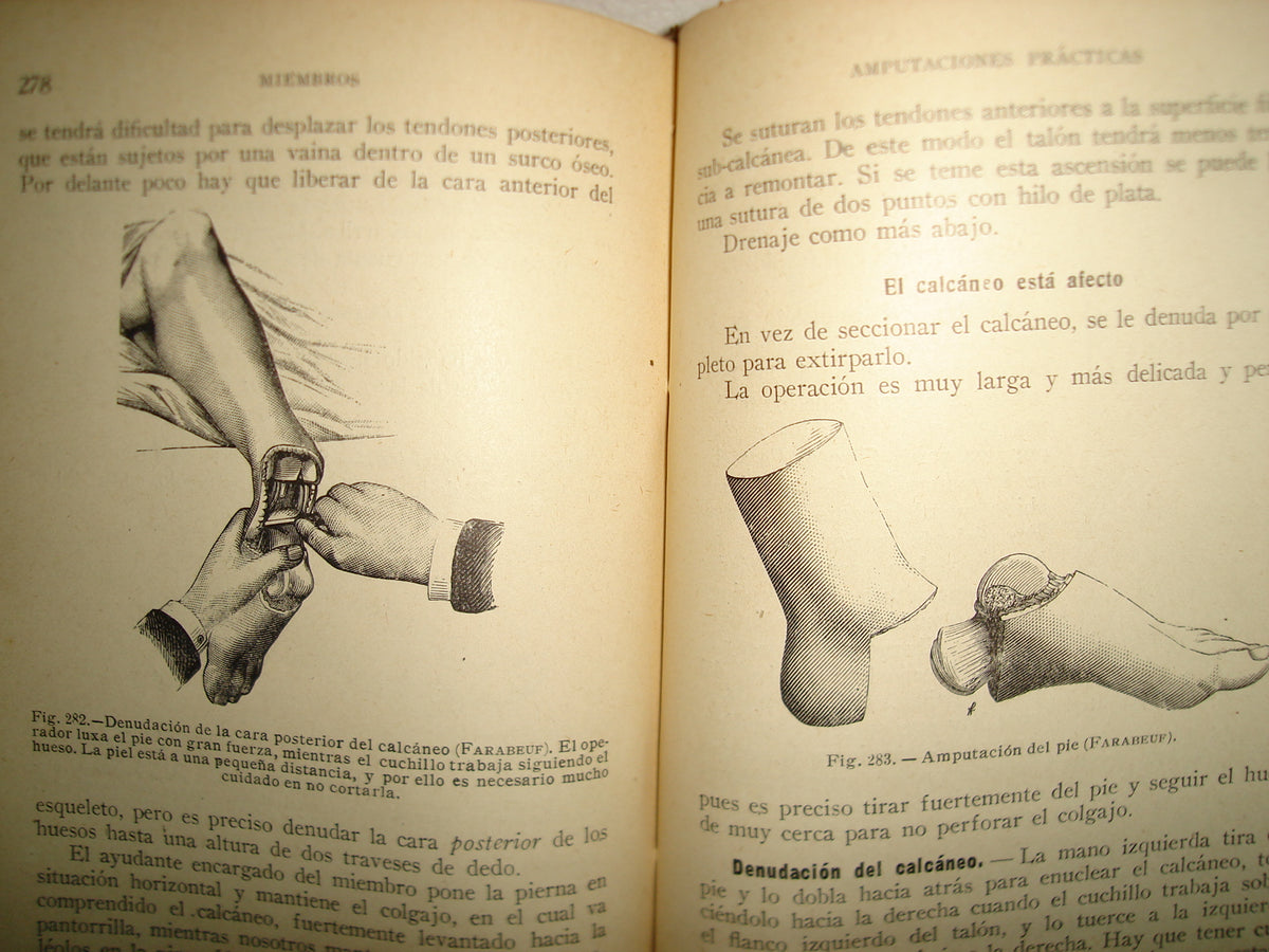 160- Práctica Corriente Y Cirugía De Urgencia - V. Veau Y F. D'Allaines - 1928