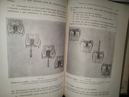 92- Antiguo Libro De Odontología: Técnica De Dentística Conservadora. Preparación De Cavidades - Dr. Alejandro Zabotinsky - 1952