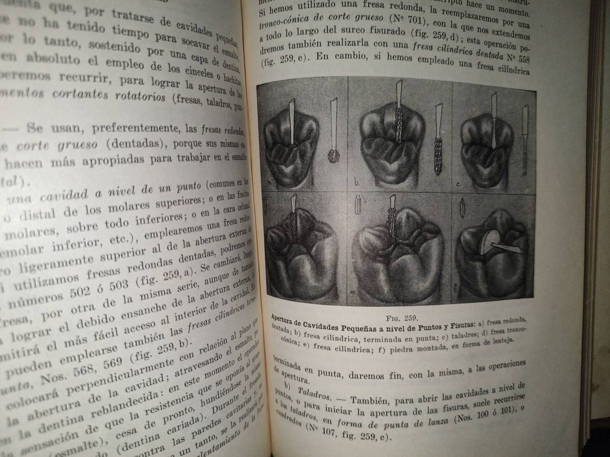 92- Antiguo Libro De Odontología: Técnica De Dentística Conservadora. Preparación De Cavidades - Dr. Alejandro Zabotinsky - 1952