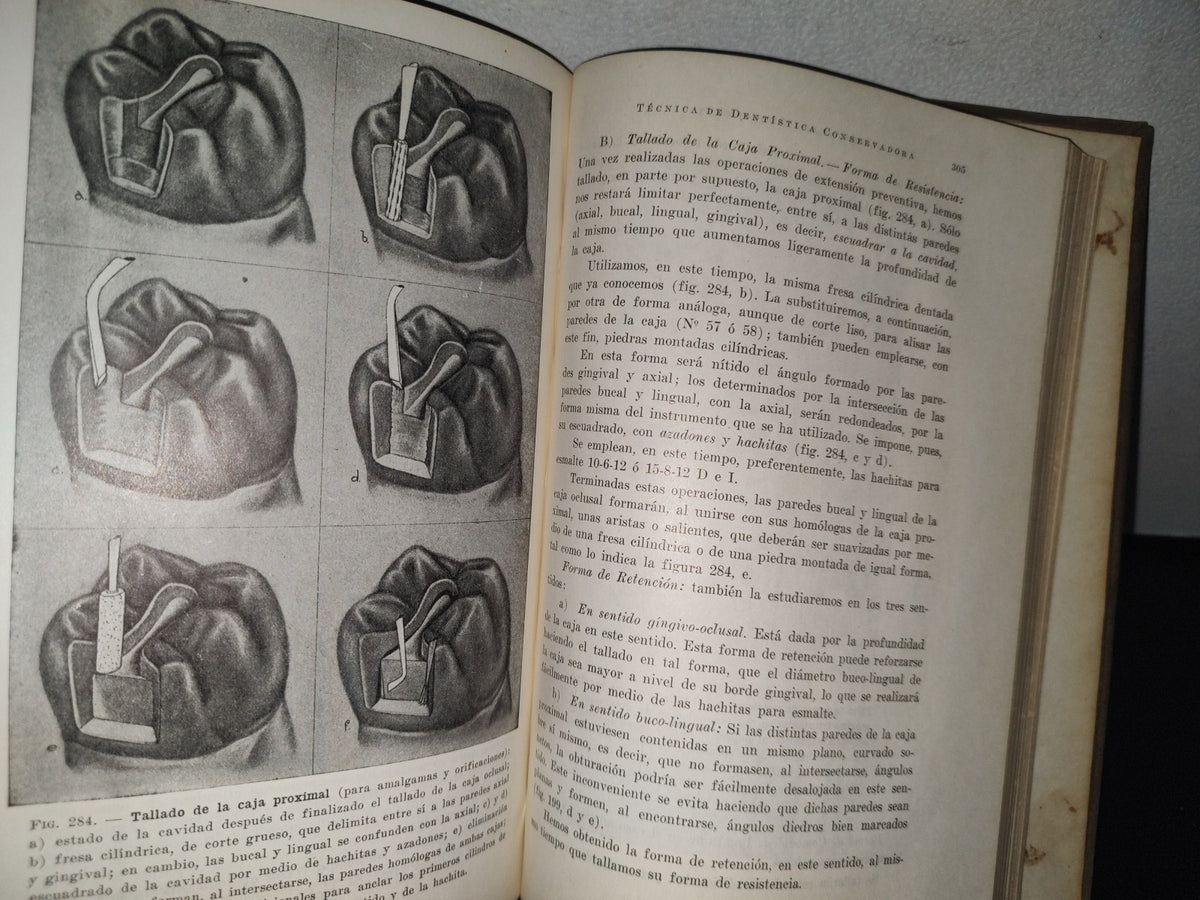 92- Antiguo Libro De Odontología: Técnica De Dentística Conservadora. Preparación De Cavidades - Dr. Alejandro Zabotinsky - 1952