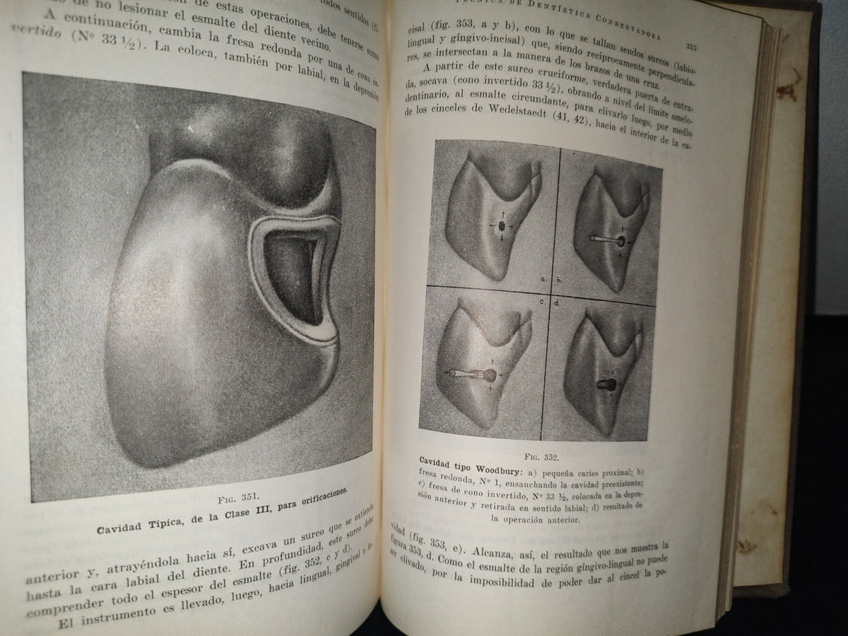 92- Antiguo Libro De Odontología: Técnica De Dentística Conservadora. Preparación De Cavidades - Dr. Alejandro Zabotinsky - 1952