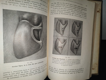 92- Antiguo Libro De Odontología: Técnica De Dentística Conservadora. Preparación De Cavidades - Dr. Alejandro Zabotinsky - 1952