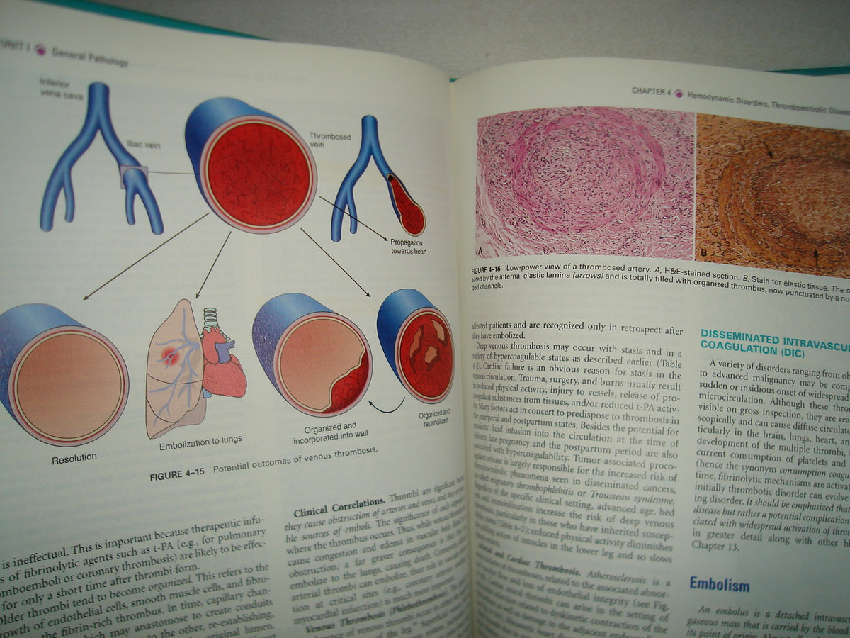 20- Inglés - Robbins And Cotran. Pathologic Basis Of Disease 7Th Edition - Kumar, Abbas, Fausto