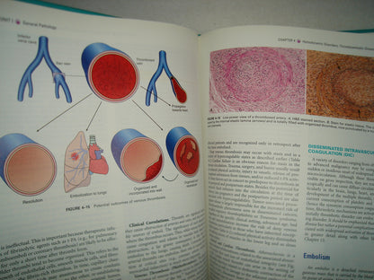 20- Inglés - Robbins And Cotran. Pathologic Basis Of Disease 7Th Edition - Kumar, Abbas, Fausto