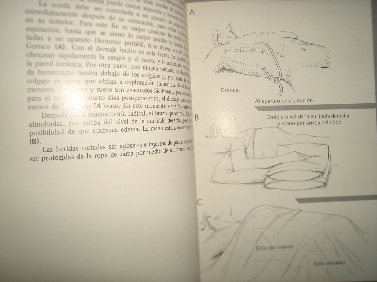 168- Cirugía De La Mama - Southwick, Slaughter, Humphrey - 1968