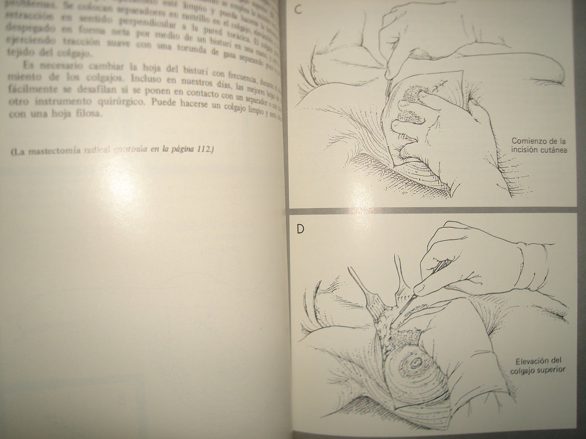 168- Cirugía De La Mama - Southwick, Slaughter, Humphrey - 1968