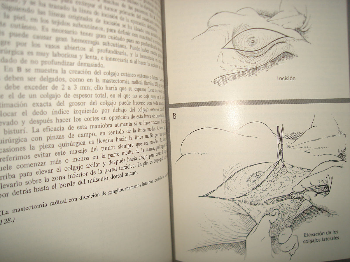 168- Cirugía De La Mama - Southwick, Slaughter, Humphrey - 1968