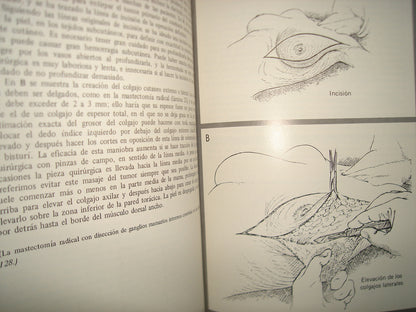 168- Cirugía De La Mama - Southwick, Slaughter, Humphrey - 1968