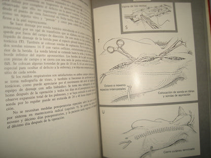 168- Cirugía De La Mama - Southwick, Slaughter, Humphrey - 1968