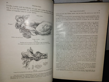 64- Francés. Compendio De Obstetricia / Précis D'Obstétrique En 28 Leçons - Ernest Bumm - 1911