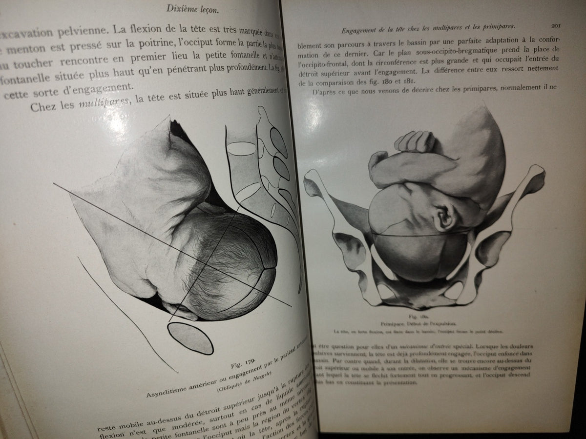 64- Francés. Compendio De Obstetricia / Précis D'Obstétrique En 28 Leçons - Ernest Bumm - 1911