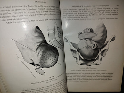 64- Francés. Compendio De Obstetricia / Précis D'Obstétrique En 28 Leçons - Ernest Bumm - 1911