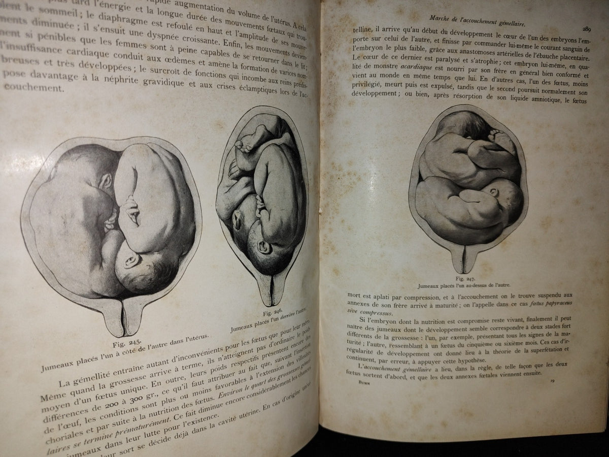 64- Francés. Compendio De Obstetricia / Précis D'Obstétrique En 28 Leçons - Ernest Bumm - 1911