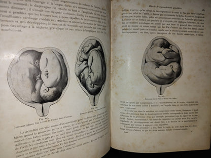 64- Francés. Compendio De Obstetricia / Précis D'Obstétrique En 28 Leçons - Ernest Bumm - 1911
