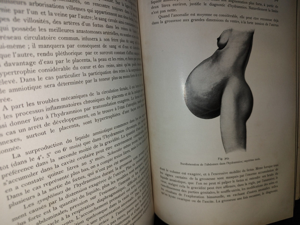64- Francés. Compendio De Obstetricia / Précis D'Obstétrique En 28 Leçons - Ernest Bumm - 1911