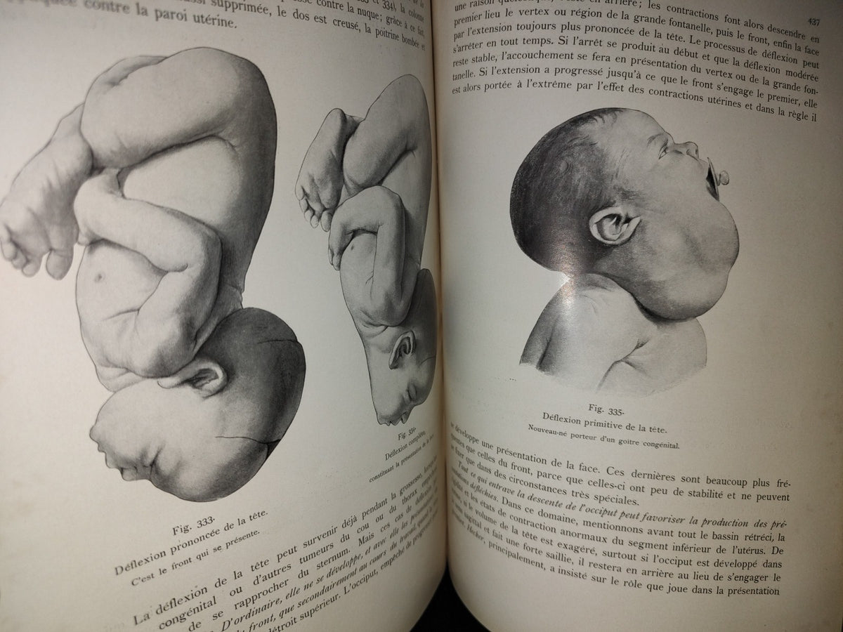 64- Francés. Compendio De Obstetricia / Précis D'Obstétrique En 28 Leçons - Ernest Bumm - 1911