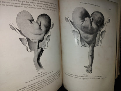 64- Francés. Compendio De Obstetricia / Précis D'Obstétrique En 28 Leçons - Ernest Bumm - 1911