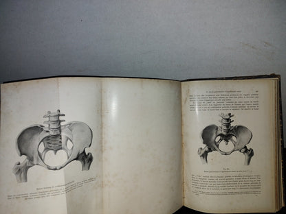 64- Francés. Compendio De Obstetricia / Précis D'Obstétrique En 28 Leçons - Ernest Bumm - 1911
