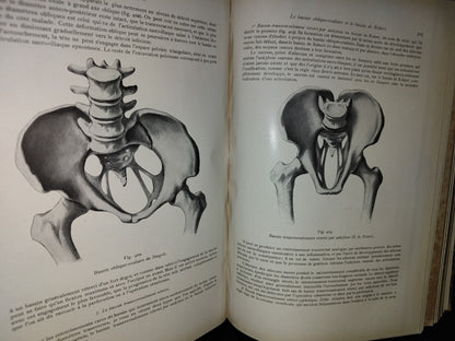 64- Francés. Compendio De Obstetricia / Précis D'Obstétrique En 28 Leçons - Ernest Bumm - 1911