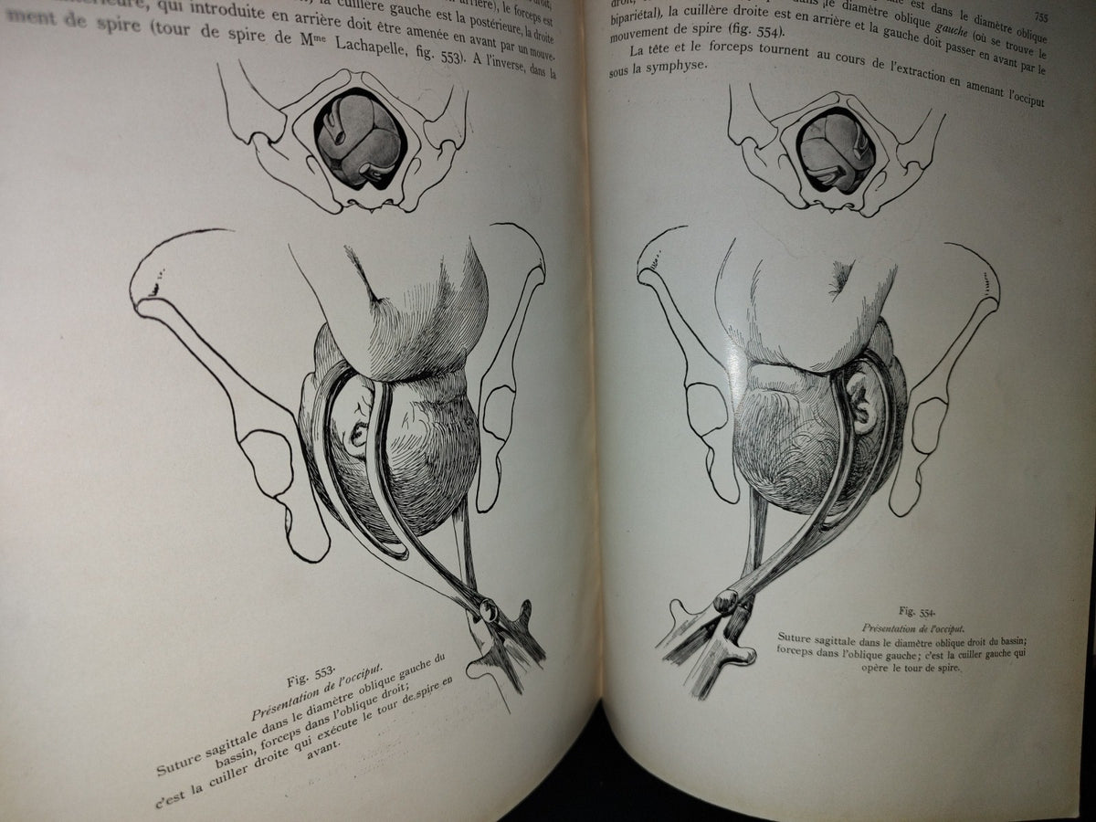 64- Francés. Compendio De Obstetricia / Précis D'Obstétrique En 28 Leçons - Ernest Bumm - 1911
